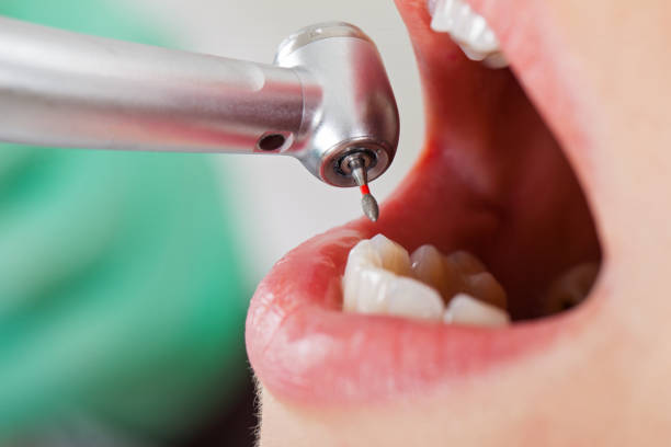 Best Emergency Broken Tooth Repair in Hockessin, DE
